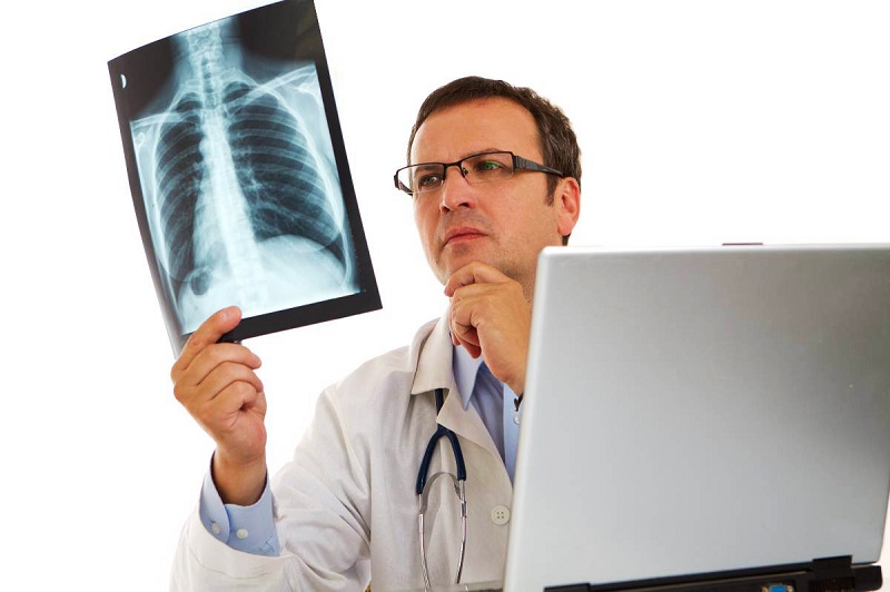 Xác định ung thư phổi thông thường cho kết quả khá chậm